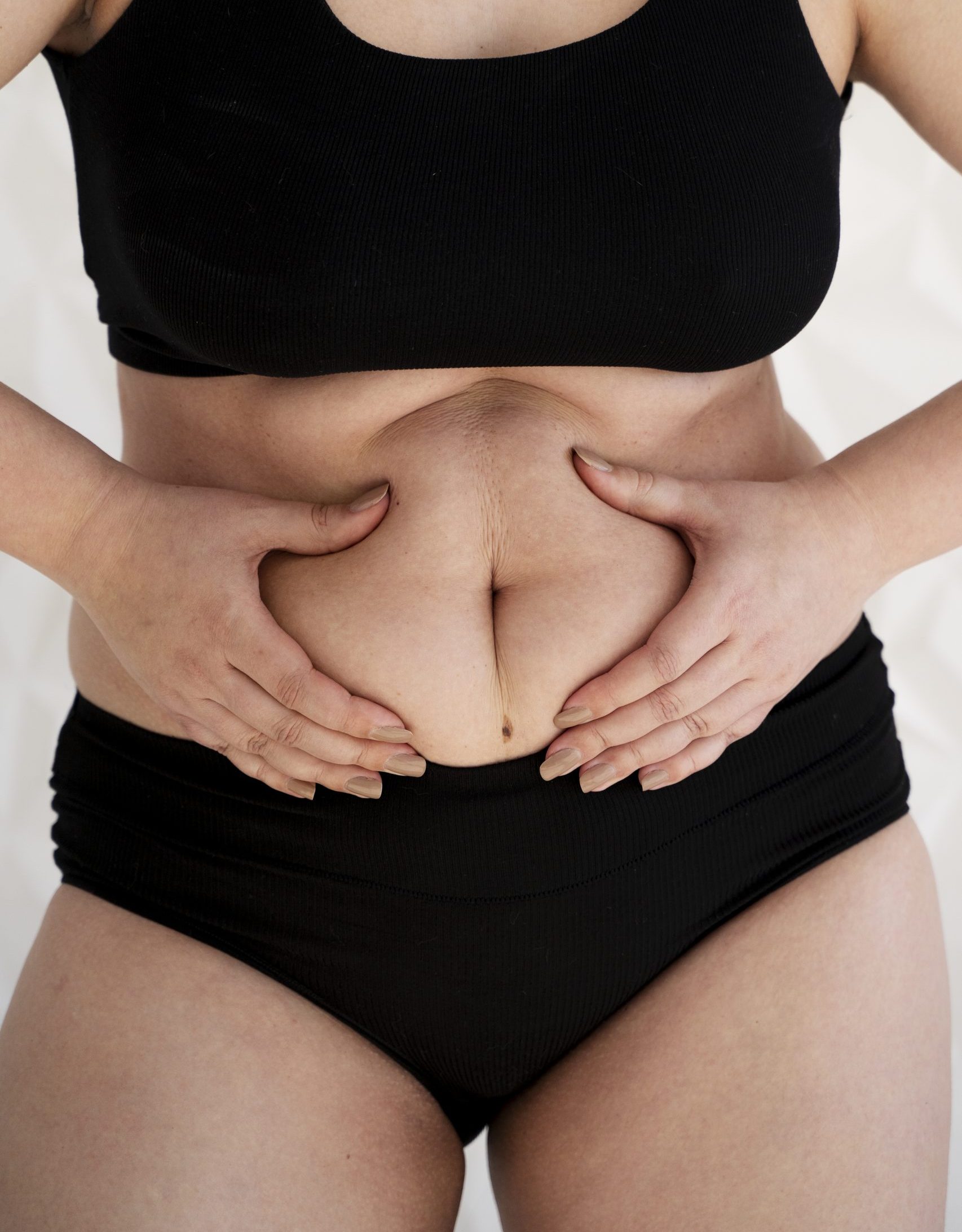 Photo d'une femme en sous-vêtement qui se tient l'abdomen. Son ventre est lourd et gonflé.